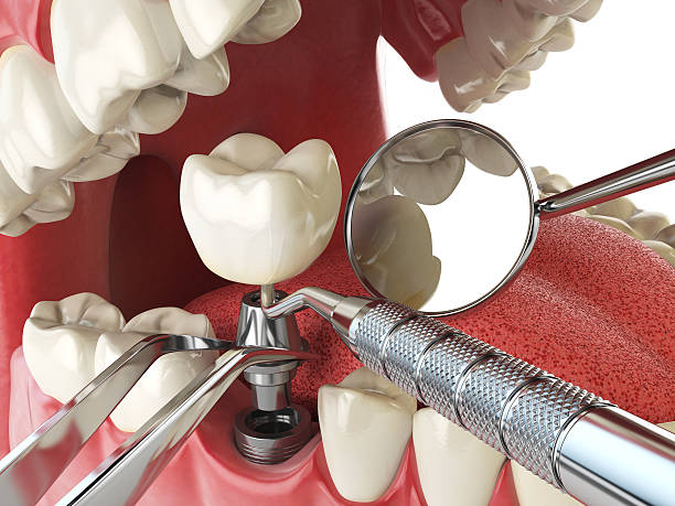 Best Emergency Dental Services for Seniors in Woodbury, TN